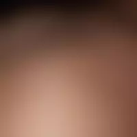 Louloubadoo69