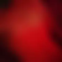 Jplaisir72