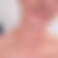Kevsx20cm