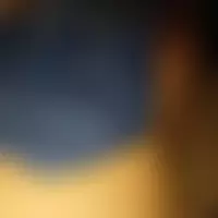 Dnrr